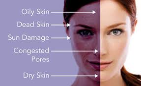 Skinscanner huidanalyse Skinclinic Nijmegen - Resi Peters
